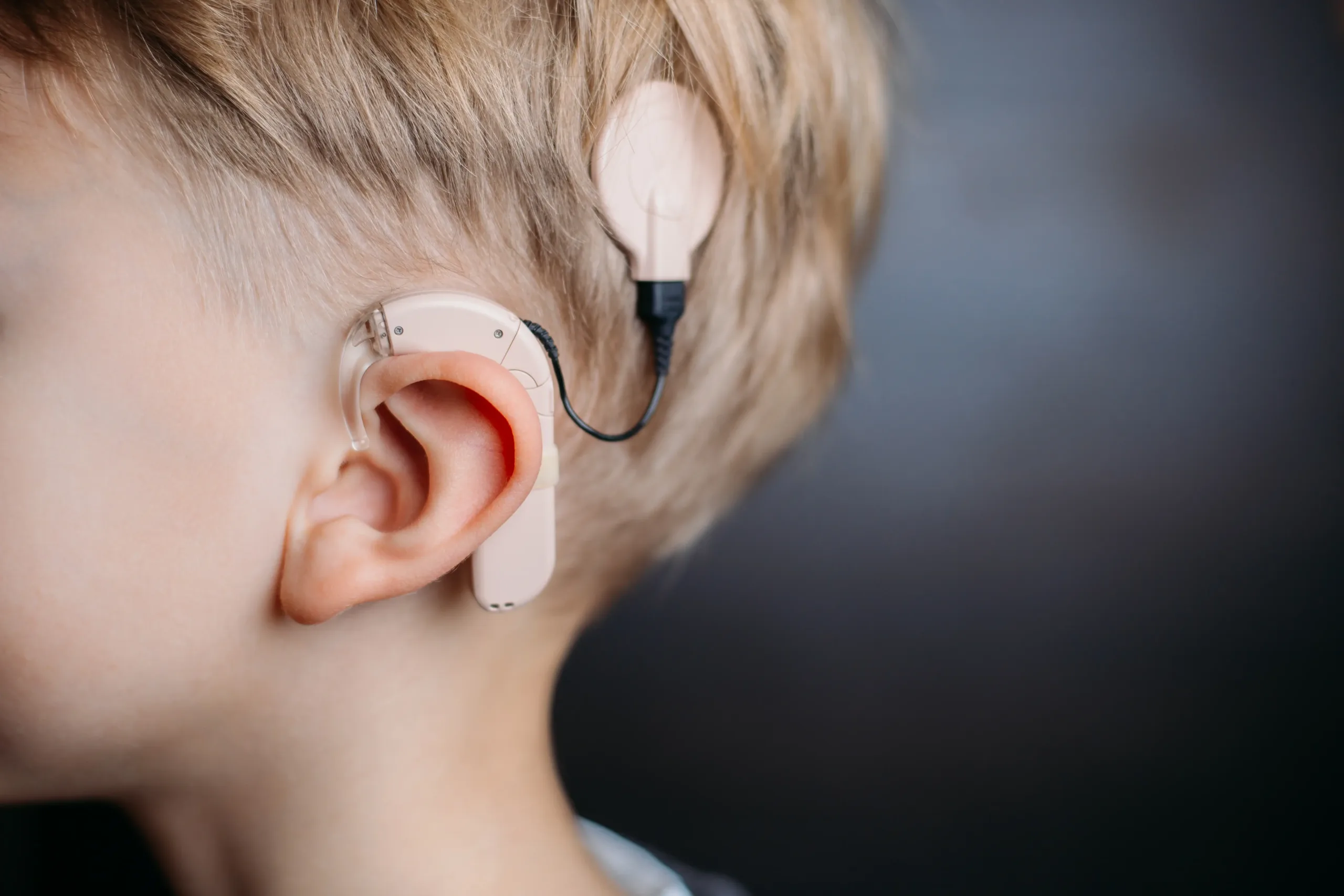 child cochlear implant